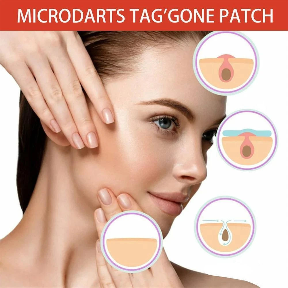 DermaDot™ MicroDarts – Smärtfri borttagning av hudflikar