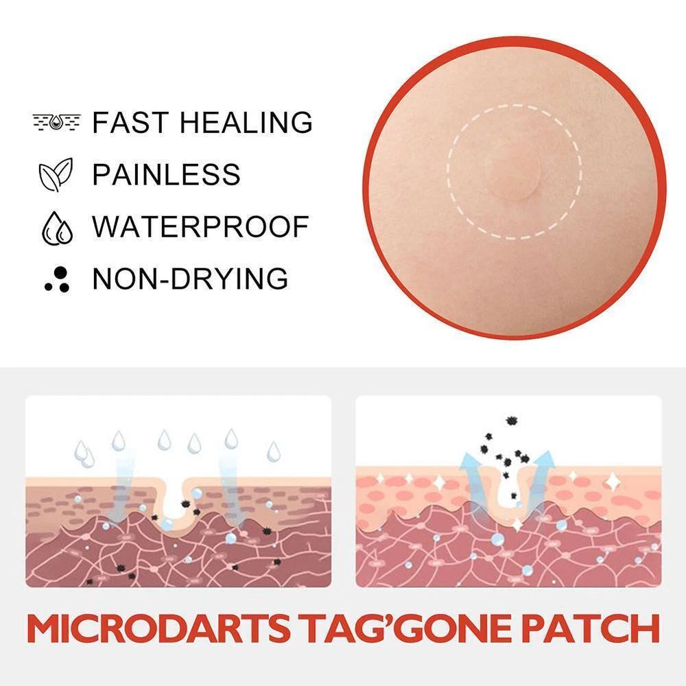 DermaDot™ MicroDarts – Smärtfri borttagning av hudflikar