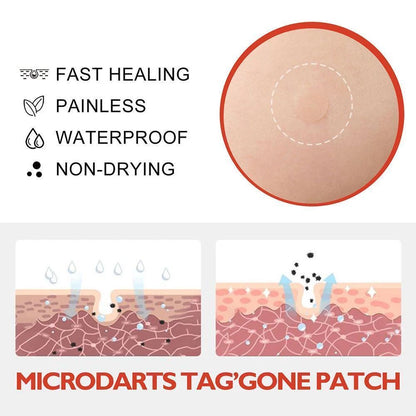 DermaDot™ MicroDarts – Smärtfri borttagning av hudflikar